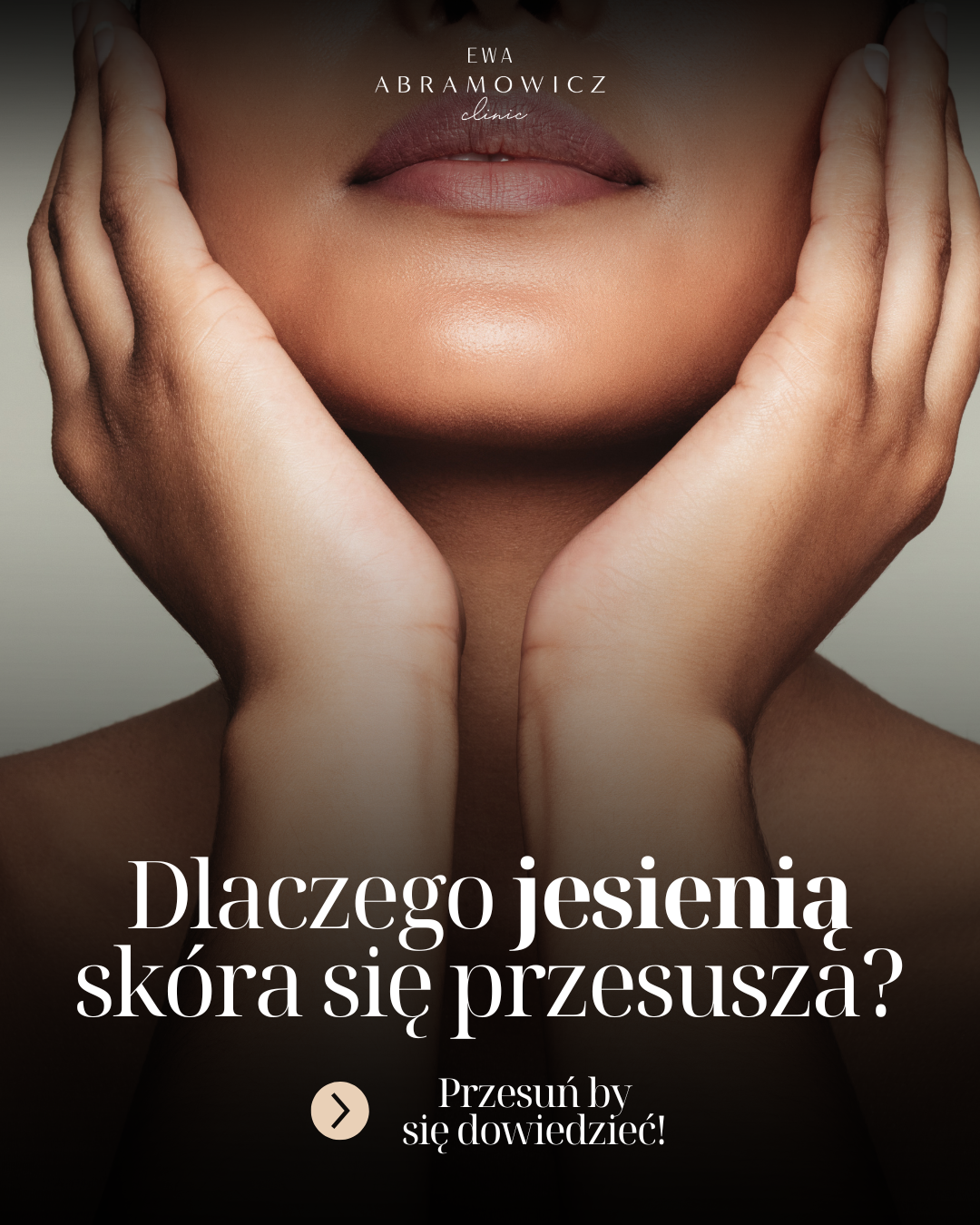 ABRAMOWICZ KARUZELE (16)